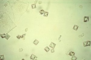 Articles scientifiques : Calcium Oxalate Crystals
