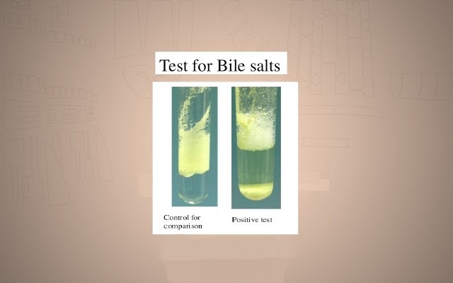 Article scientifique :Principe et procédure du test des sels biliaires (méthode du test de Hay,