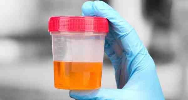 Article scientifique Principes d'analyses urinaires,laboratoire Maroc