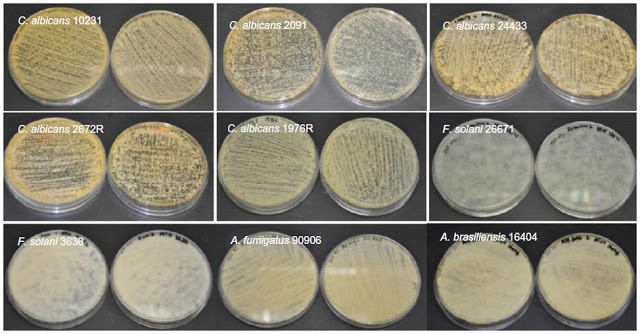 Articles scientifiques : Sabouraud Dextrose Agar (SDA) Composition, principe, utilisations, préparation, culture et morphologie des colonies