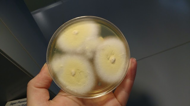 Articles scientifiques : Sabouraud Dextrose Agar (SDA) Composition, principe, utilisations, préparation, culture et morphologie des colonies