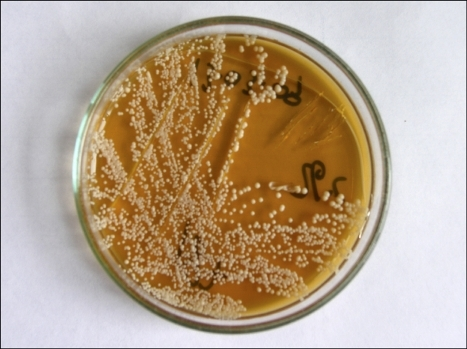 Articles scientifiques : Sabouraud Dextrose Agar (SDA) Composition, principe, utilisations, préparation, culture et morphologie des colonies