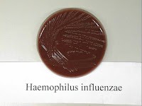 Articles scientifiques : Haemophilus influenzae : Caractéristiques, Habitat, Pathogénicité, Diagnostic, Tests biochimiques et traitement