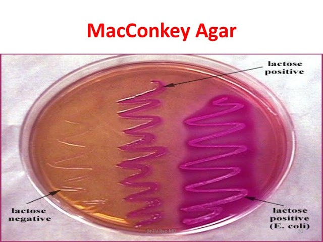 Articles scientifique : Gélose Salmonella-Shigella (SS) : Principe, composition, préparation, inoculation et morphologie de la colonie