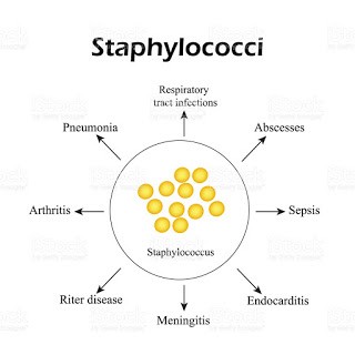 Articles scientifiques : Staphylocoques : Identification, diagnostic et traitement