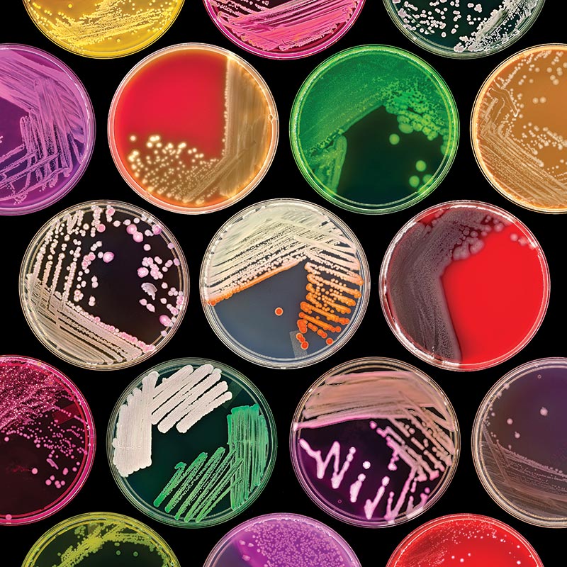 Milieux de culture | Massart Santé - Matériel médical et de laboratoire